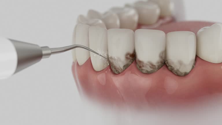 Reliable Dental contractor in Haltom City, TX by Dentist Open Now